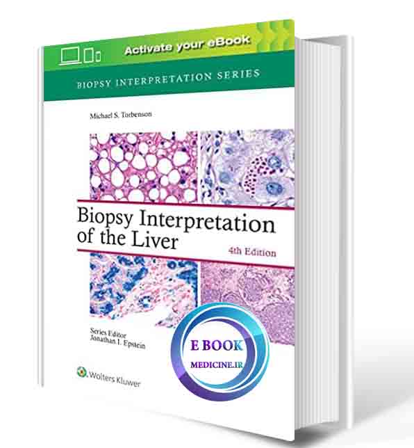 دانلود کتابBiopsy Interpretation of the Liver (Biopsy Interpretation Series) 2021 (PDF)